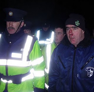 Pat O'Donnell after Garda Assault
