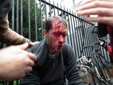 Victim of Garda Assault at student anti-cuts demo